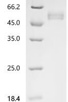 Macaca fascicularis Natural cytotoxicity triggering receptor 3 (NCR3), partial Recombinant Protein - BioCrest Sci