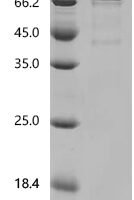 Macaca mulatta Interleukin 1 receptor type 1 (IL1R1), partial Recombinant Protein - BioCrest Sci