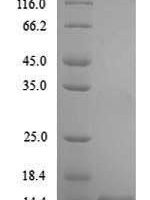 Oncorhynchus mykiss Transforming growth factor beta-1 (TGFB1) Recombinant Protein - BioCrest Sci