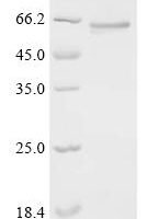 Nepenthes gracilis Aspartic proteinase nepenthesin-2 (nep2) Recombinant Protein, N-His-KSI - BioCrest Sci
