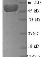 Escherichia coli Mannose-6-phosphate isomerase (manA) Recombinant Protein - BioCrest Sci