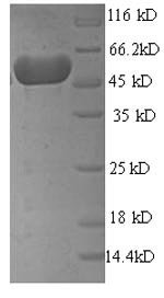 Escherichia coli Mannose-6-phosphate isomerase (manA) Recombinant Protein, Escherichia coli (strain K12), E.coli, N-terminal 6xHis-SUMO-tagged, 58.8 kDa, purity >≥ 90% as determined by SDS-PAGE.
