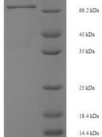 Mouse Interferon regulatory factor 5 (Irf5) Recombinant Protein - BioCrest Sci