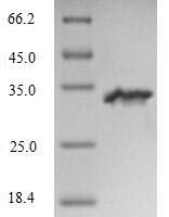 Human Ryanodine receptor 3 (RYR3), partial Recombinant Protein, N-His - BioCrest Sci