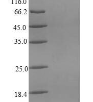 Chicken Interleukin-8 (CXCL8), partial Recombinant Protein - BioCrest Sci