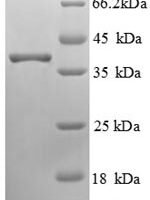 Human RING-box protein 2 (RNF7) Recombinant Protein, N-GST - BioCrest Sci