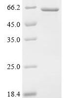 Human Coronin-1A (CORO1A) Recombinant Protein - BioCrest Sci