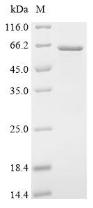 Human Coronin-1A (CORO1A) Recombinant Protein, Homo sapiens (Human), E.coli, C-terminal 6xHis-tagged, 57.8 kDa, purity >≥ 85% as determined by SDS-PAGE.