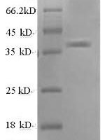 Human DNA repair nuclease/redox regulator APEX1 (APEX1) Recombinant Protein, N-His, aa 32–318, Yeast - BioCrest Sci