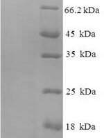 Human Nucleolar GTP-binding protein 2 (GNL2) Recombinant Protein - BioCrest Sci