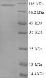 Human Nucleolar GTP-binding protein 2 (GNL2) Recombinant Protein, Homo sapiens (Human), E.coli, N-terminal 6xHis-SUMO-tagged, 99.7 kDa, purity >≥ 90% as determined by SDS-PAGE.