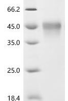 Human Tumor necrosis factor receptor superfamily member 1B (TNFRSF1B), partial Recombinant Protein, C-Twin-Strep-Avi - BioCrest Sci