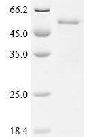 Escherichia coli O6:H1 Cardiolipin synthase A (clsA) , partial Recombinant Protein - BioCrest Sci