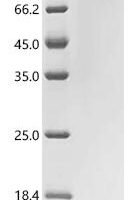 Human Integrin beta-6 (ITGB6), partial Recombinant Protein - BioCrest Sci