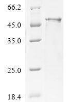 Rat Stromelysin-1 (Mmp3) Recombinant Protein - BioCrest Sci