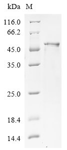 Rat Stromelysin-1 (Mmp3) Recombinant Protein, Rattus norvegicus (Rat), E.coli, N-terminal 6xHis-tagged, 48.5 kDa, purity >≥ 85% as determined by SDS-PAGE.