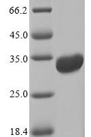 Escherichia coli Heat-labile enterotoxin A chain (eltA) Recombinant Protein, N-10His/C-Myc - BioCrest Sci