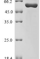 Human C-C motif chemokine 1 (CCL1),Biotinylated Recombinant Protein - BioCrest Sci