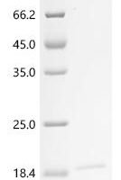 Human Voltage-dependent calcium channel gamma-1 subunit (CACNG1), partial Recombinant Protein - BioCrest Sci