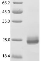 Human Tumor necrosis factor ligand superfamily member 12 (TNFSF12), partial Recombinant Protein, N-His-Myc - BioCrest Sci