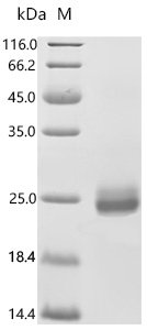 Human Tumor necrosis factor ligand superfamily member 12 (TNFSF12), partial Recombinant Protein, N-His-Myc, Mammalian cell, N-terminal 6xHis-Myc-tagged, 21.3 kDa, purity >≥ 95% as determined by SDS-PAGE.