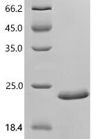 Rat Natriuretic peptides A(Nppa), partial Recombinant Protein - BioCrest Sci