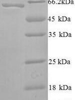 Human Probable global transcription activator SNF2L2 (SMARCA2), partial Recombinant Protein, N-His, aa 700–1216 - BioCrest Sci