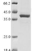 Human Glutaminyl-peptide cyclotransferase (QPCT) Recombinant Protein - BioCrest Sci