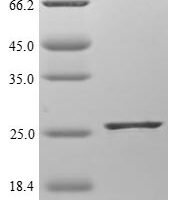Mouse CB1 cannabinoid receptor-interacting protein 1 (Cnrip1) Recombinant Protein - BioCrest Sci