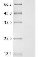 Human Ribonucleoside-diphosphate reductase large subunit (RRM1) Recombinant Protein, C-His - BioCrest Sci
