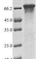 Human Terminal nucleotidyltransferase 4A (TENT4A), partial Recombinant Protein - BioCrest Sci