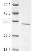 Human Protein L-Myc (MYCL), partial Recombinant Protein - BioCrest Sci