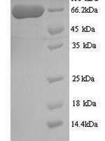 Human Twinkle mtDNA helicase (TWNK) Recombinant Protein - BioCrest Sci