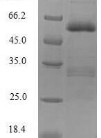 Human E3 ubiquitin-protein ligase SIAH1 (SIAH1) Recombinant Protein - BioCrest Sci
