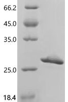 Human Heterogeneous nuclear ribonucleoproteins A2/B1 (HNRNPA2B1), partial Recombinant Protein, N-His - BioCrest Sci