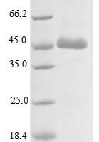 Human Actin-like protein 8 (ACTL8) Recombinant Protein, N-His/C-Myc - BioCrest Sci