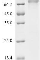 Human FERM domain-containing protein 5 (FRMD5) Recombinant Protein - BioCrest Sci