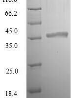 Escherichia coli Murein tetrapeptide carboxypeptidase (ldcA) Recombinant Protein - BioCrest Sci