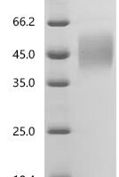 Human Interleukin-10 receptor subunit alpha (IL10RA), partial Recombinant Protein, C-10His - BioCrest Sci