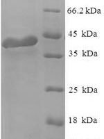 Human Regulator of G-protein signaling 2 (RGS2) Recombinant Protein - BioCrest Sci