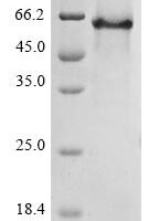 Neosartorya fumigata 1,3-beta-glucanosyltransferase gel4 (gel4) Recombinant Protein - BioCrest Sci