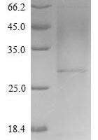 Variola virus Protein OPG154 (OPG154) Recombinant Protein, N-His - BioCrest Sci