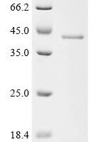 Oncorhynchus mykiss Cytochrome P450 1A1 (cyp1a1), partial Recombinant Protein - BioCrest Sci