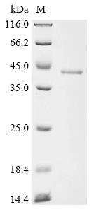 Oncorhynchus mykiss Cytochrome P450 1A1 (cyp1a1), partial Recombinant Protein, Oncorhynchus mykiss (Rainbow trout) (Salmo gairdneri), E.coli, N-terminal 10xHis-tagged and C-terminal Myc-tagged, 43.7 kDa, purity >≥ 85% as determined by SDS-PAGE.