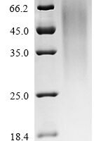 Human Metal cation symporter ZIP14 (SLC39A14), partial Recombinant Protein - BioCrest Sci