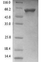 Candida albicans Secreted aspartic protease 9 (SAP9) Recombinant Protein, N-His - BioCrest Sci