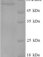 Human Cellular tumor antigen p53 (TP53) Recombinant Protein, N-His-SUMO - BioCrest Sci