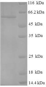 Human Cellular tumor antigen p53 (TP53) Recombinant Protein, N-His-SUMO, Homo sapiens (Human), E.coli, N-terminal 6xHis-SUMO-tagged, 59.7 kDa, purity >≥ 90% as determined by SDS-PAGE.