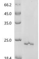 Rat Neurotrophin-3 (Ntf3) Recombinant Protein - BioCrest Sci