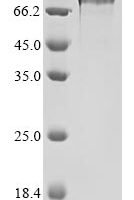 Human Protein PAT1 homolog 1 (PATL1) Recombinant Protein - BioCrest Sci